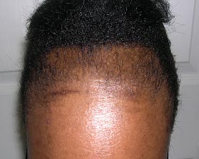 realfro